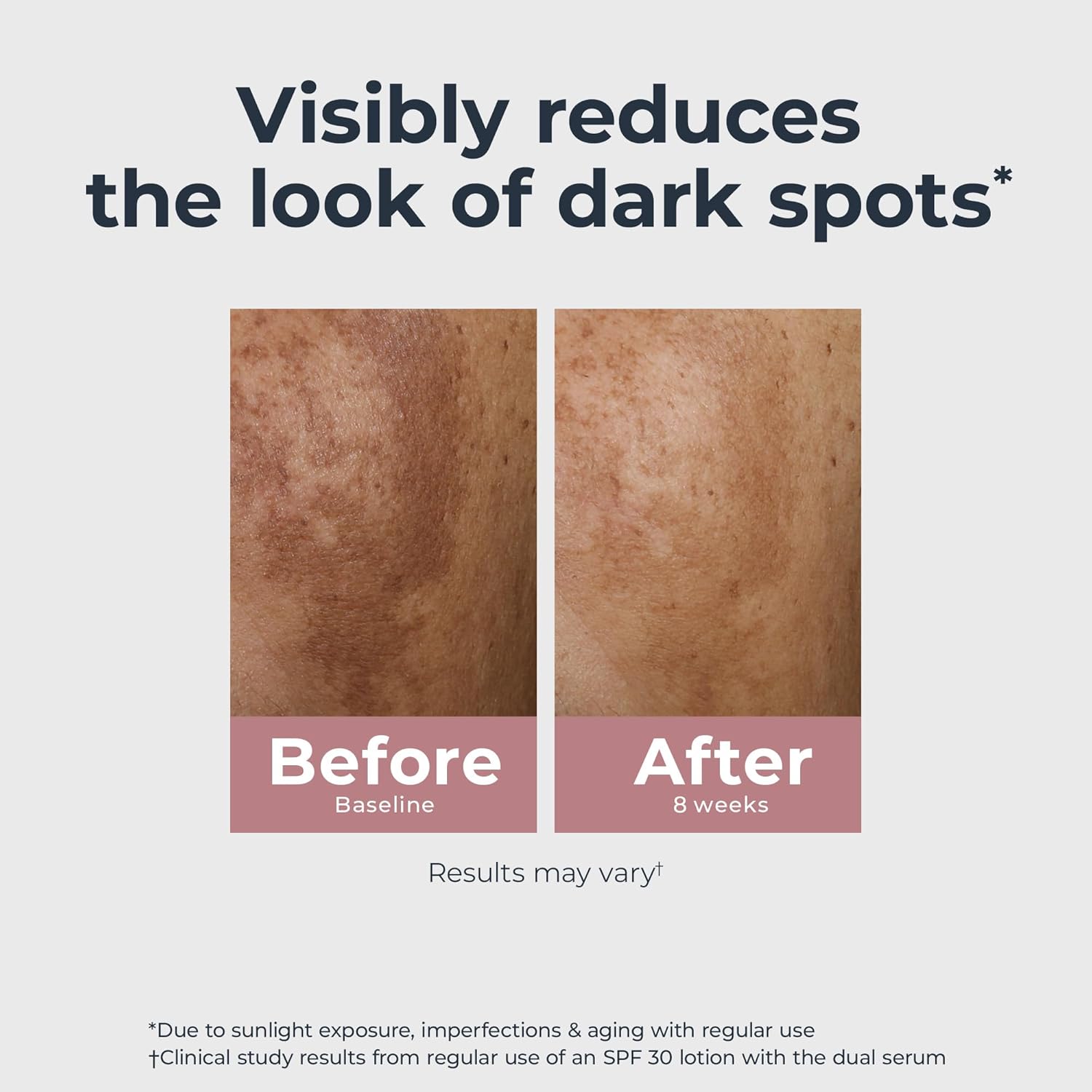 Radiant Tone Dual Repair Serum