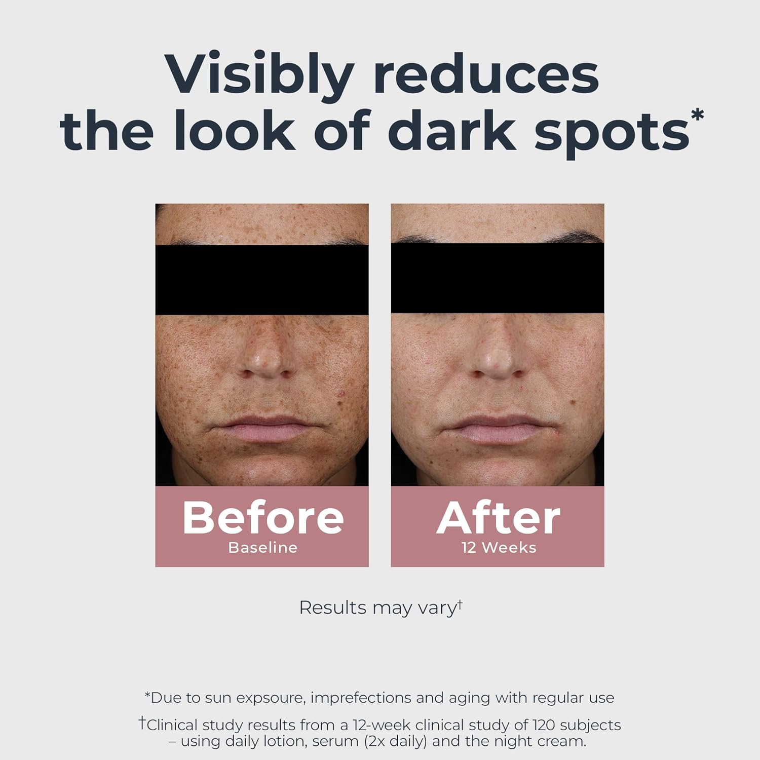 Radiant Tone Dual Repair Serum